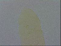 Echiniscus spiniger image