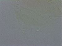 Echiniscus spiniger image
