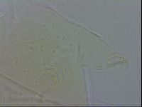 Echiniscus spiniger image