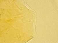 Echiniscus spiniger image