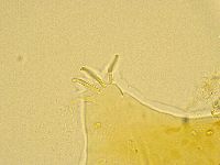 Echiniscus spiniger image