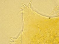 Echiniscus spiniger image