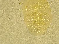 Echiniscus spiniger image
