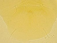 Echiniscus spiniger image