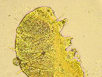 Echiniscus spinulosus image