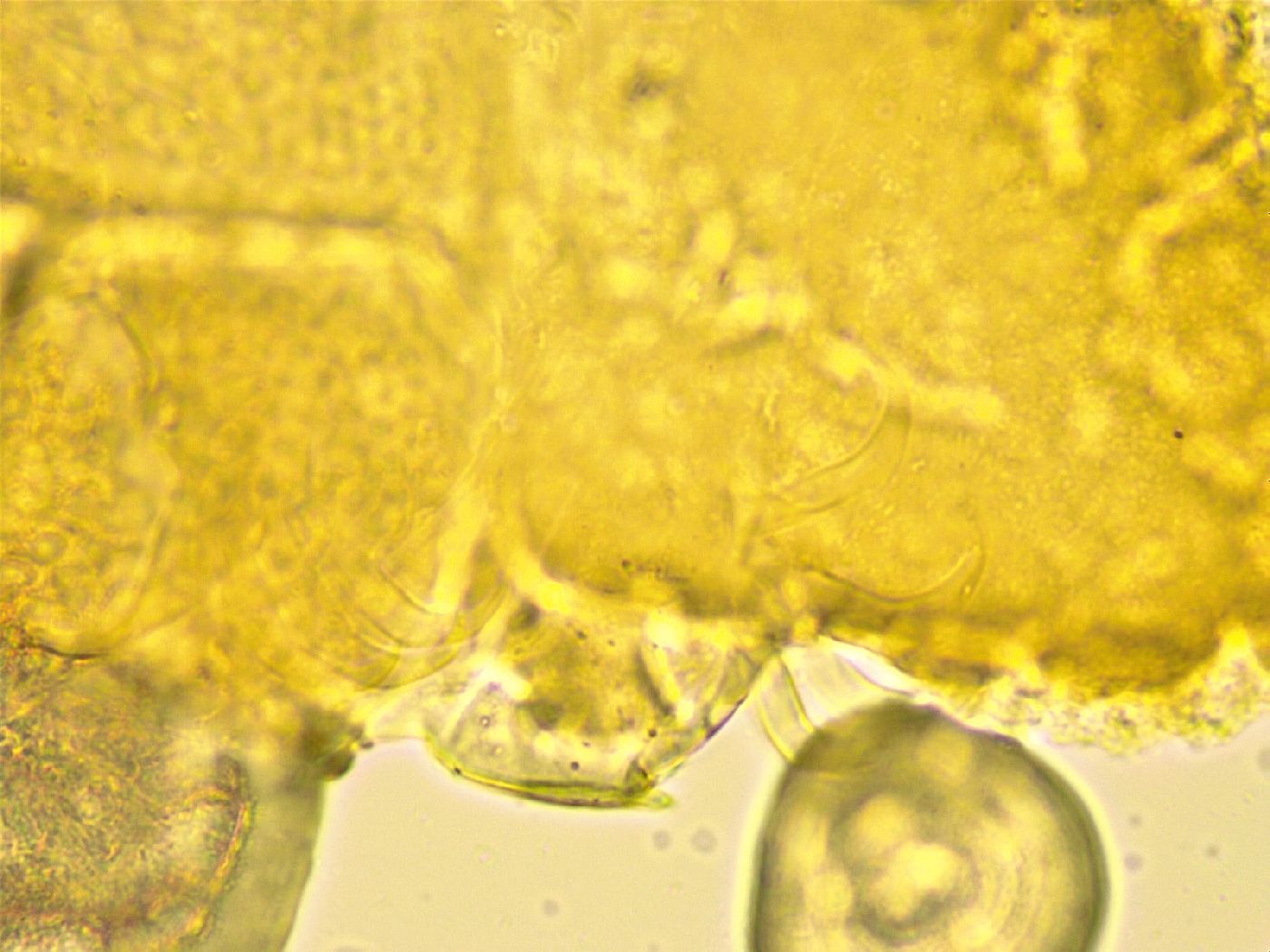 Echiniscus spinulosus image