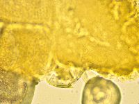Echiniscus spinulosus image