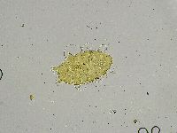 Testechiniscus spinuloides image