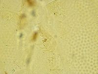 Testechiniscus spinuloides image