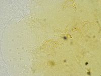 Echiniscus tamus image