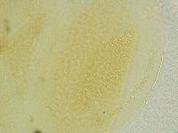 Echiniscus tamus image