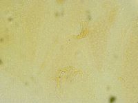 Echiniscus tamus image