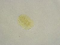 Echiniscus tamus image