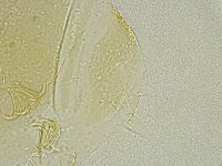 Echiniscus tamus image