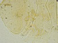 Media resource of Echiniscus tamus