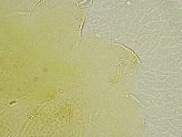 Echiniscus tamus image