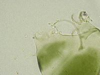 Media resource of Echiniscus viridissimus