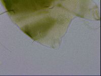 Echiniscus viridissimus image