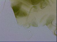 Echiniscus viridissimus image