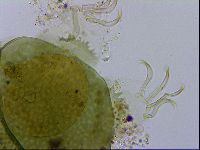 Echiniscus viridissimus image