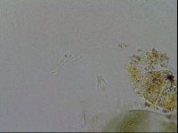 Echiniscus viridissimus image