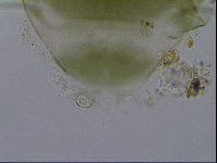 Echiniscus viridissimus image
