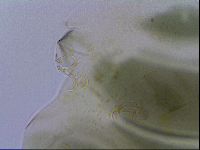 Echiniscus viridis image