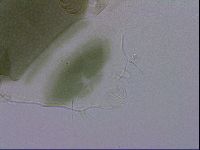 Echiniscus viridis image