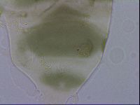 Echiniscus viridis image