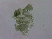 Echiniscus viridis image