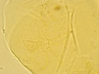 Echiniscus wendti image