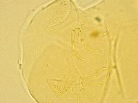 Echiniscus wendti image