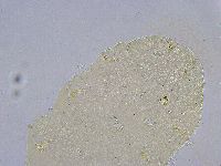 Echiniscus wendti image