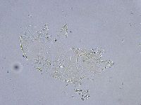 Echiniscus wendti image