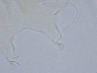 Echiniscus wendti image