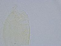 Echiniscus wendti image