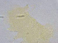 Echiniscus wendti image