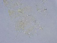 Echiniscus wendti image