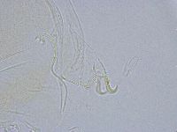 Echiniscus wendti image