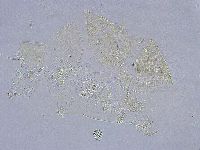 Echiniscus wendti image