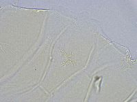 Echiniscus wendti image