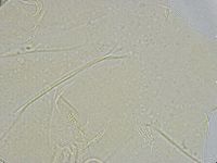 Echiniscus wendti image
