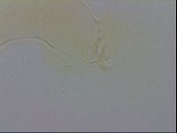 Media resource of Echiniscus wendti