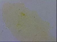 Echiniscus wendti image