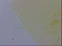 Echiniscus wendti image