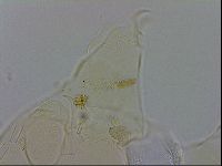 Echiniscus wendti image