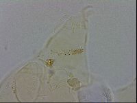 Echiniscus wendti image