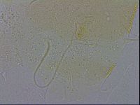 Echiniscus wendti image