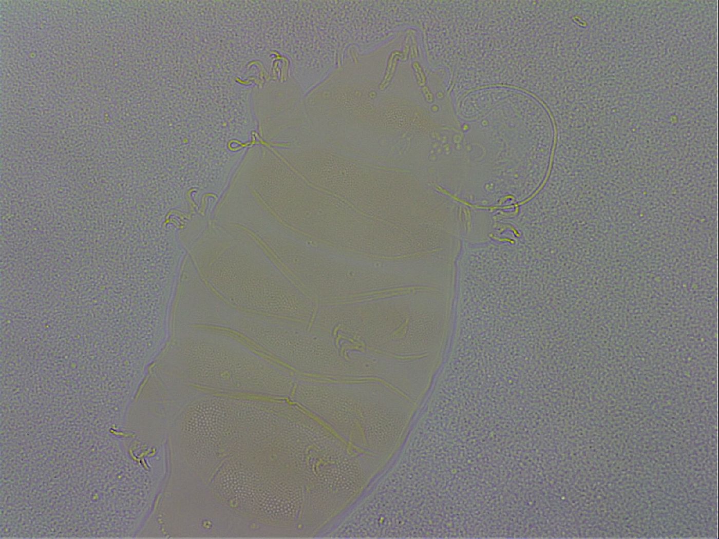 Echiniscus wendti image
