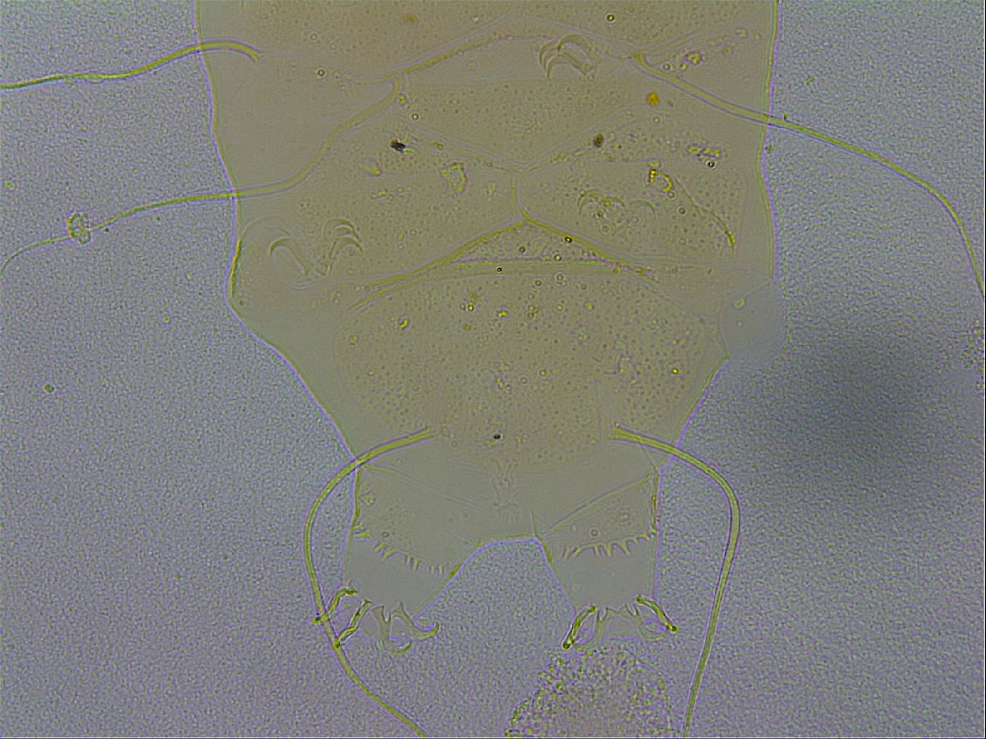 Echiniscus zetotrymus image